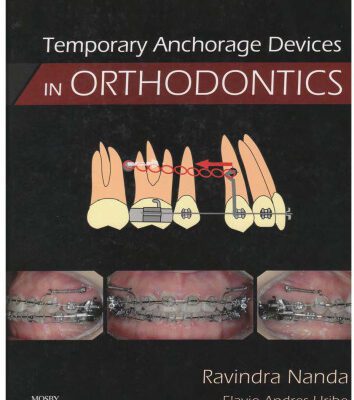 خرید و دانلود نسخه کامل کتاب Temporary Anchorage Devices in Orthodontics