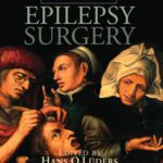خرید و دانلود نسخه کامل کتاب Textbook of Epilepsy Surgery
