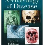 خرید و دانلود نسخه کامل کتاب The Archaeology of Disease