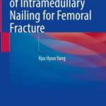 خرید و دانلود نسخه کامل کتاب The Art of Intramedullary Nailing for Femoral Fracture