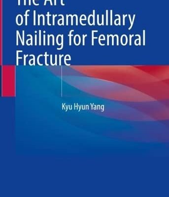 خرید و دانلود نسخه کامل کتاب The Art of Intramedullary Nailing for Femoral Fracture