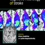 خرید و دانلود نسخه کامل کتاب The Behavioral and Cognitive Neurology of Stroke