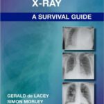 خرید و دانلود نسخه کامل کتاب The Chest X-Ray: A Survival Guide