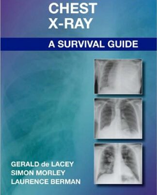 خرید و دانلود نسخه کامل کتاب The Chest X-Ray: A Survival Guide