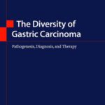 خرید و دانلود نسخه کامل کتاب The Diversity of Gastric Carcinoma: Pathogenesis, Diagnosis and Therapy