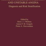 خرید و دانلود نسخه کامل کتاب The ECG in Acute Myocardial Infarction and Unstable Angina (Developments in Cardiovascular Medicine)