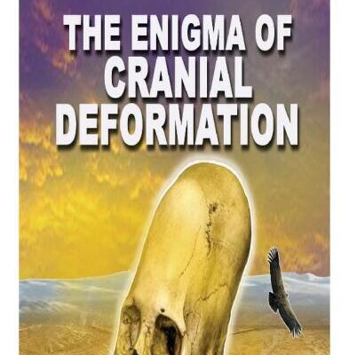 خرید و دانلود نسخه کامل کتاب The Enigma of Cranial Deformation: Elongated Skulls of the Ancients