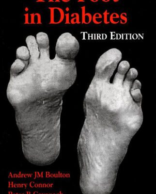 خرید و دانلود نسخه کامل کتاب The Foot in Diabetes, 3rd Edition