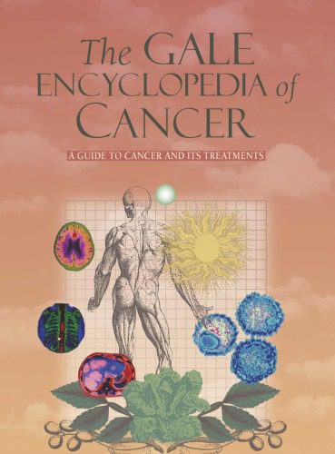 خرید و دانلود نسخه کامل کتاب The Gale encyclopedia of cancer: a guide to cancer and its treatments_68bb1acfe39de.jpeg خرید و دانلود نسخه کامل کتاب The Gale encyclopedia of cancer: a guide to cancer and its treatments