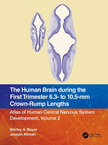 خرید و دانلود نسخه کامل کتاب The Human Brain during the First Trimester 6.3- to 10.5-mm Crown-Rump Lengths_68b92c441c503.jpeg خرید و دانلود نسخه کامل کتاب The Human Brain during the First Trimester 6.3- to 10.5-mm Crown-Rump Lengths