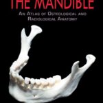 خرید و دانلود نسخه کامل کتاب The Mandible: An Atlas of Osteological and Radiological Anatomy