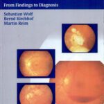 خرید و دانلود نسخه کامل کتاب The Ocular Fundus: From Findings to Diagnosis