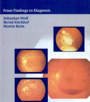 خرید و دانلود نسخه کامل کتاب The Ocular Fundus: From Findings to Diagnosis
