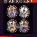 خرید و دانلود نسخه کامل کتاب The Psychopharmacology of Schizophrenia (Hodder Arnold Publication)