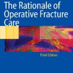 خرید و دانلود نسخه کامل کتاب The Rationale of Operative Fracture Care