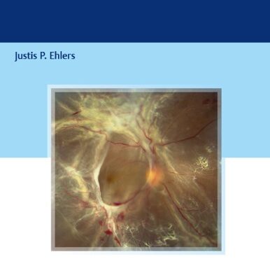 خرید و دانلود نسخه کامل کتاب The Retina Illustrated