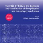 خرید و دانلود نسخه کامل کتاب The role of EEG in the diagnosis and classification of the epilepsies and the epilepsy syndromes