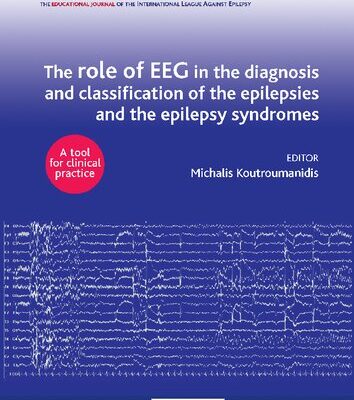 خرید و دانلود نسخه کامل کتاب The role of EEG in the diagnosis and classification of the epilepsies and the epilepsy syndromes