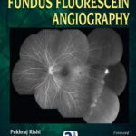 خرید و دانلود نسخه کامل کتاب The Sankara Nethralaya Atlas of Fundus Fluorescein Angiography
