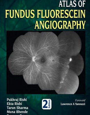 خرید و دانلود نسخه کامل کتاب The Sankara Nethralaya Atlas of Fundus Fluorescein Angiography