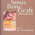 خرید و دانلود نسخه کامل کتاب The Sinus Bone Graft
