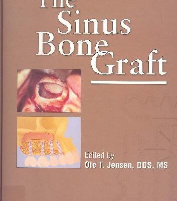 خرید و دانلود نسخه کامل کتاب The Sinus Bone Graft
