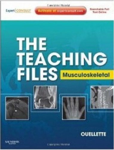 خرید و دانلود نسخه کامل کتاب The Teaching Files: Musculoskeletal_68b6545d0962f.jpeg خرید و دانلود نسخه کامل کتاب The Teaching Files: Musculoskeletal