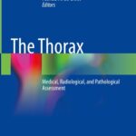 خرید و دانلود نسخه کامل کتاب The Thorax: Medical, Radiological, and Pathological Assessment