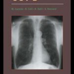 خرید و دانلود نسخه کامل کتاب Therapeutic Strategies in COPD