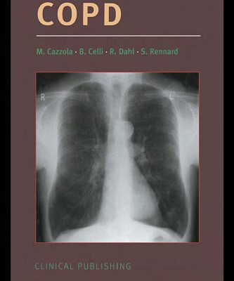 خرید و دانلود نسخه کامل کتاب Therapeutic Strategies in COPD