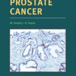 خرید و دانلود نسخه کامل کتاب Therapeutic Strategies in Prostate Cancer