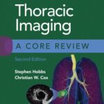 خرید و دانلود نسخه کامل کتاب Thoracic Imaging: A Core Review