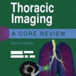خرید و دانلود نسخه کامل کتاب Thoracic Imaging: A Core Review