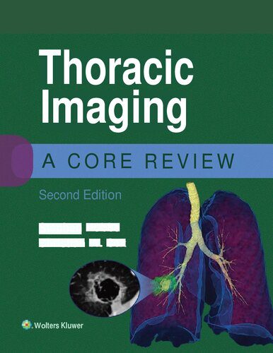 خرید و دانلود نسخه کامل کتاب Thoracic Imaging: A Core Review_68bb1d69a32ce.jpeg خرید و دانلود نسخه کامل کتاب Thoracic Imaging: A Core Review