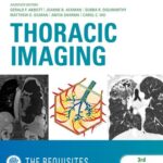 خرید و دانلود نسخه کامل کتاب Thoracic Imaging: The Requisites (Requisites in Radiology)
