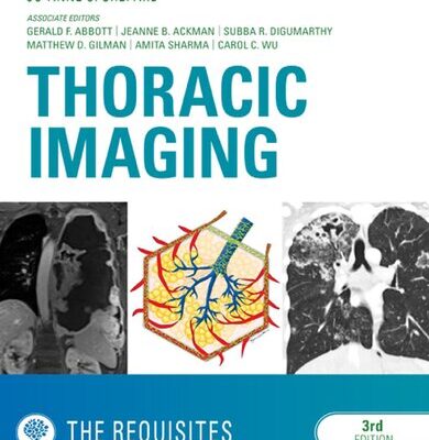 خرید و دانلود نسخه کامل کتاب Thoracic Imaging: The Requisites (Requisites in Radiology)