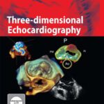 خرید و دانلود نسخه کامل کتاب Three-dimensional Echocardiography