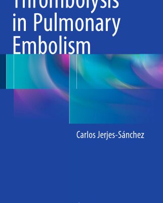 خرید و دانلود نسخه کامل کتاب Thrombolysis in Pulmonary Embolism