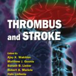 خرید و دانلود نسخه کامل کتاب Thrombus and Stroke (Neurological Disease and Therapy)
