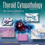 خرید و دانلود نسخه کامل کتاب Thyroid Cytopathology