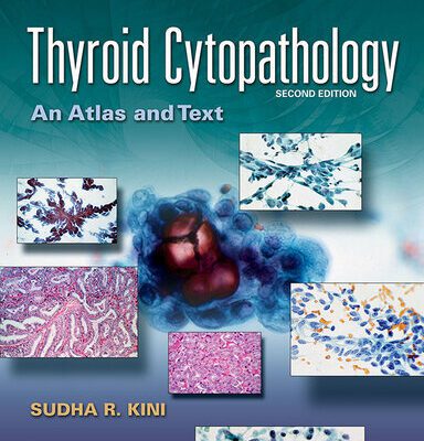 خرید و دانلود نسخه کامل کتاب Thyroid Cytopathology