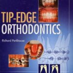 خرید و دانلود نسخه کامل کتاب Tip Edge Orthodontics