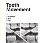خرید و دانلود نسخه کامل کتاب Tooth Movement