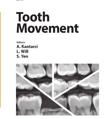 خرید و دانلود نسخه کامل کتاب Tooth Movement