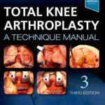 خرید و دانلود نسخه کامل کتاب Total Knee Arthroplasty: A Technique Manual