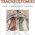 خرید و دانلود نسخه کامل کتاب Tracheostomies: The Complete Guide