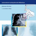 خرید و دانلود نسخه کامل کتاب Trainer Thoraxdiagnostik: Systematische kardiopulmonale Bildanalyse – Orginal Pdf