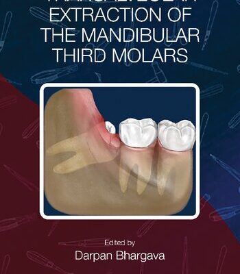 خرید و دانلود نسخه کامل کتاب Transalveolar Extraction of the Mandibular Third Molars