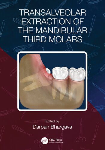 خرید و دانلود نسخه کامل کتاب Transalveolar Extraction of the Mandibular Third Molars_68bbe2ccb0b1a.jpeg خرید و دانلود نسخه کامل کتاب Transalveolar Extraction of the Mandibular Third Molars