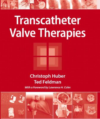 خرید و دانلود نسخه کامل کتاب Transcatheter Valve Therapies